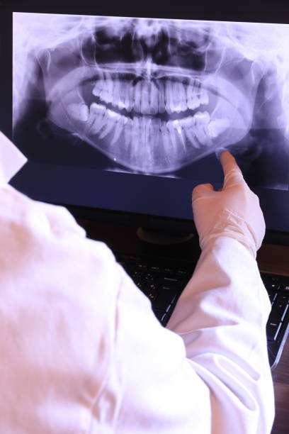 Best Emergency Dental Services for Seniors in Cordele, GA