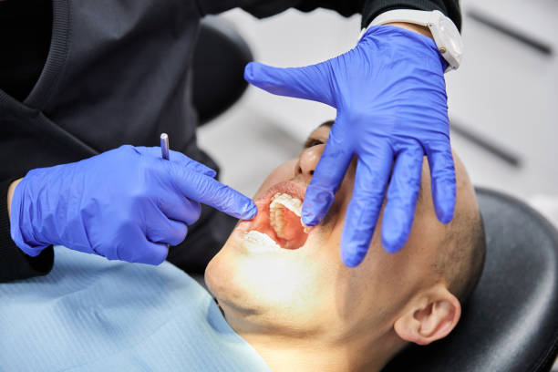 Best Emergency Dentist for Knocked-Out Tooth in Cordele, GA